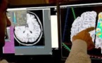 Le Big Data espoir dans la lutte contre Alzheimer