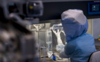 Fin de l'épidémie de virus de Marburg en Guinée équatoriale