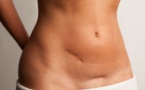 « Le traitement des cicatrices par thérapie manuelle », par Karine Wong, chiropracteur de Papeete