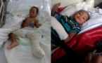 Tehaunui, 2 ans, gravement brûlé, est arrivé en Nouvelle-Zélande