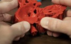 La bio-impression 3D sauve des enfants malades, une première prometteuse