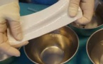 Implants: interdiction d'un produit pour la reconstruction mammaire
