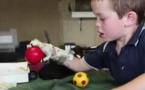 L'impression 3D veut donner une main aux enfants qui n'en ont pas