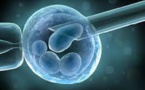 Des spermatozoïdes in vitro, un espoir pour des milliers d'hommes infertiles