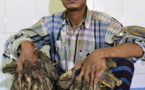 Bangladesh: un "homme-arbre" aux excroissances impressionnantes opéré