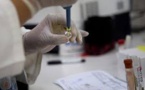 Zika: pas de tests de vaccins à grande échelle avant au moins 18 mois