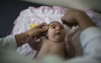 Zika: 641 cas de microcéphalie confirmés, 139 décès au Brésil
