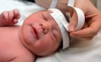 Zika: des "dizaines de milliers" de bébés pourraient naître avec des malformations ou d'autres affections