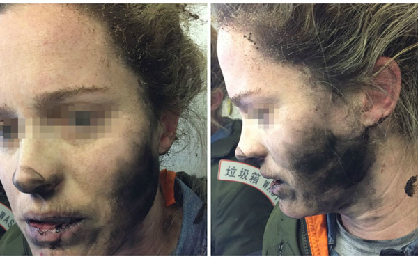 Australie: explosion en vol d'écouteurs alimentés par des batteries