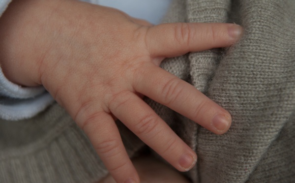 Bébés sans main: un 8e cas identifié dans l'Ain