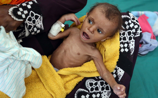 Guerre au Yémen: l'émissaire de l'ONU à Sanaa, craintes de désastre à Hodeida
