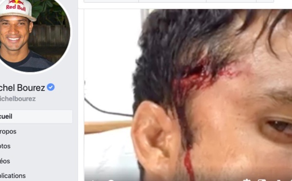 Surf libre – Michel Bourez se blesse à Teahupo’o