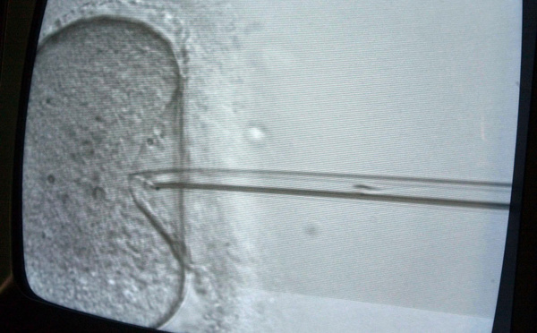 Un autre couple a porté leur enfant: une famille californienne attaque une clinique en justice