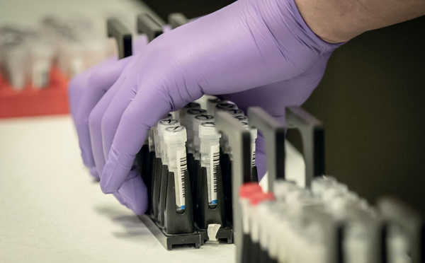 Des millions de morts du coronavirus? Eviter le scénario du pire