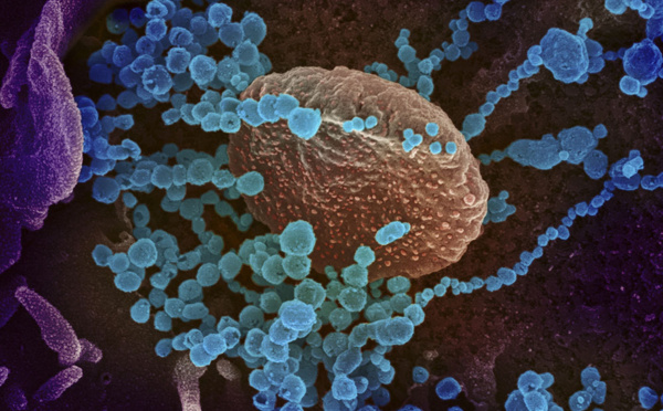 Coronavirus : plus de 33 000 morts dans le monde