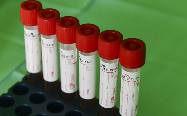 Martinique: la justice rejette une demande de dépistage systématique