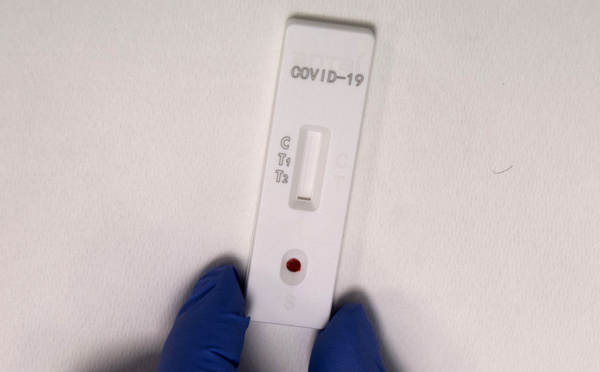 Coronavirus: moment de vérité pour les capacités de dépistage