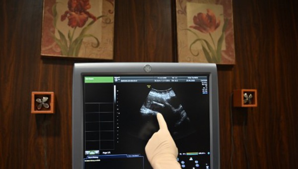 Don d'ovocytes dans un couple de femmes: le gouvernement est "contre", dit Véran