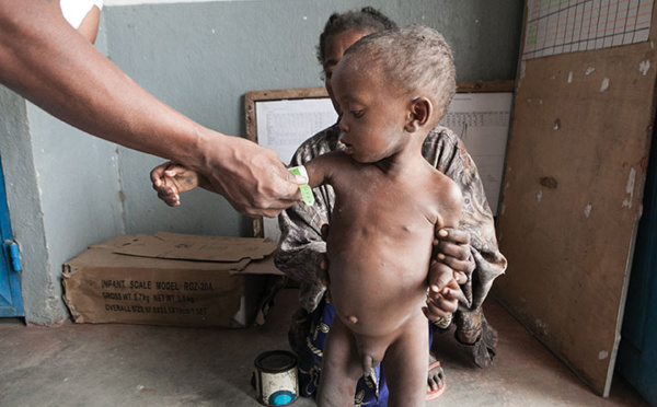 Famine à Madagascar: les silhouettes émaciées des villages "zombie"