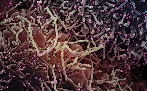 Virus: le variant Mu potentiellement préoccupant, estime le régulateur européen