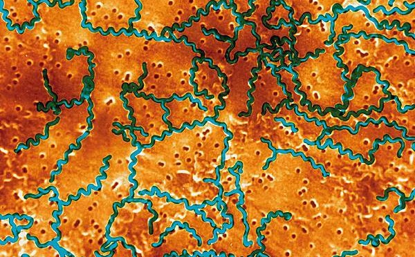 Un homme d'une soixantaine d'années décède de la leptospirose