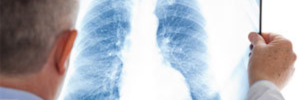 Journée mondiale contre les broncho-pneumopathies chroniques obstructives