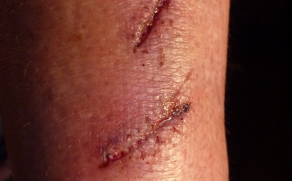 Des chiens méchants tourmentent le séjour d’un couple de touristes allemands