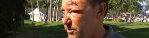 PGA - L'Australien Allenby battu et volé à Hawaï