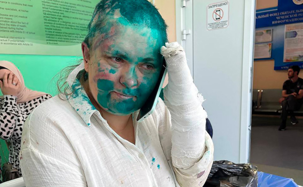 La Russie ouvre une enquête criminelle après l'attaque d'une journaliste