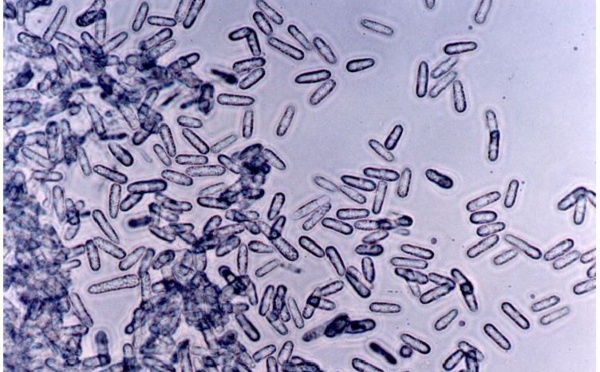 Champignon du miconia : Un généticien néo-zélandais réagit à la polémique