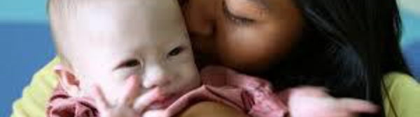 Australie: le père biologique d'un bébé trisomique accusé de vouloir mettre la main sur les dons