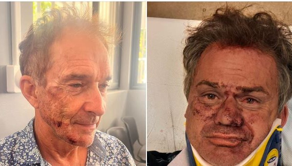 Deux touristes agressés à Papeete