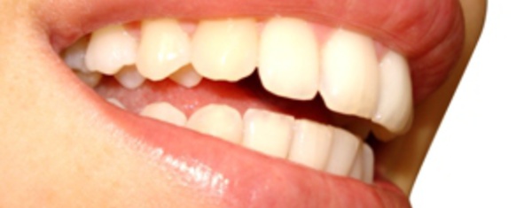 Six ans de prison pour un Néo-Zélandais qui arrachait les dents de ses conquêtes