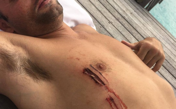 La fausse attaque de requin de Justin Bieber