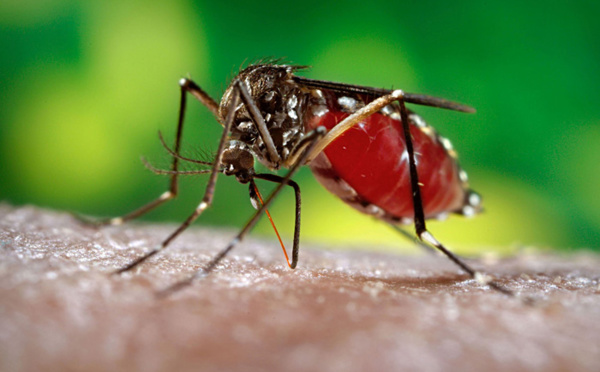 Zika : des conséquences graves sur des bébés infectés in utero