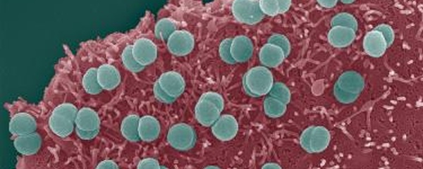 Un cas de méningocoque à Tahiti