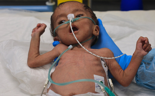 Plus de 100 ONG mettent en garde contre une "famine de masse" se propageant à Gaza