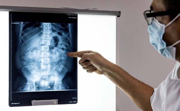 ​Une mule interpellée à l'aéroport avec de nombreux sachets de drogue dans le côlon