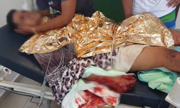 Attaque de requin à Makemo : deux blessés, dont un grave (MAJ)