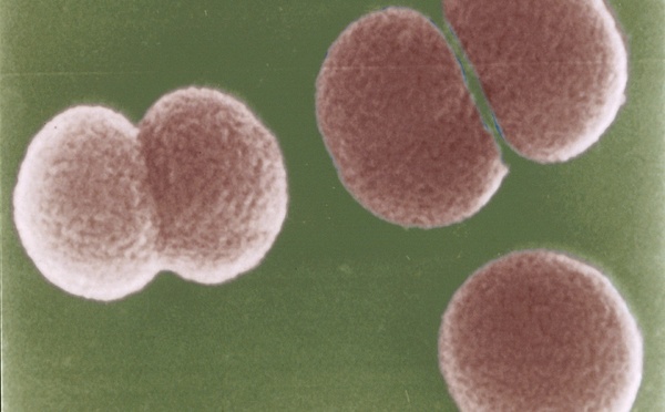 Un cas d’infection invasive à méningocoque diagnostiqué à Ua Pou