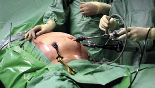 Erreur médicale fatale lors de la pose d'un anneau gastrique : peine confirmée en appel pour le chirurgien