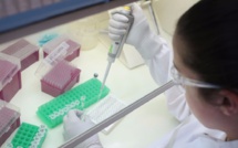 Zika peut se dupliquer dans le vagin pendant plusieurs jours (étude)