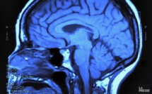 Des recherches sur la connexion entre l'oeil et le cerveau primées à Lisbonne