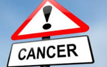 40% de cancers évitables: lancement d'une campagne de prévention