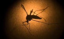 Le virus Zika trouvé à l'intérieur des spermatozoïdes (étude)