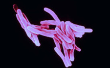 L'épidémie de tuberculose plus grave qu'on ne le pensait