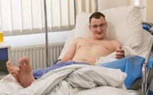 Pologne: un homme né sans main bénéficie d'une greffe
