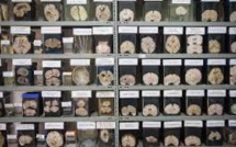 Au Pérou, un musée pour scruter les cerveaux malades