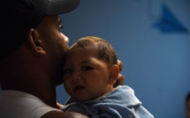 USA: des malformations congénitales liées au Zika vingt fois plus fréquentes