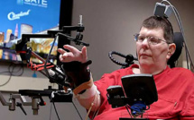 Totalement paralysé, il réussit à se servir de son bras grâce à des implants cérébraux